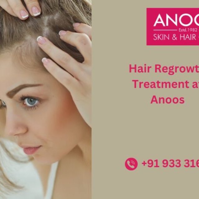 Advanced Hair Regrowth Treatment at Anoos