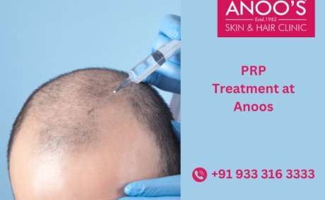 Advanced PRP Treatment for Hair at Anoos